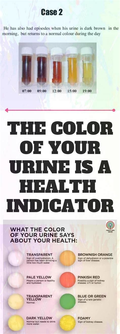 Urine Color Is One Of The Body S Indicators If It Is Receiving Enough