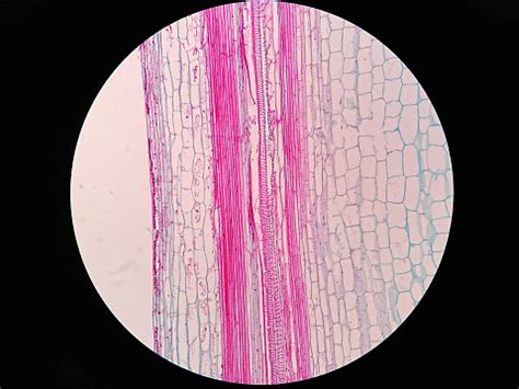 To conduct photosynthesis and to produce sugar. Plant Stem Long Section Under Microscope View Stock Photo ...