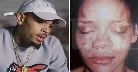 Chris Brown Breaks Silence On Rihanna Domestic Abuse In New Documentary Daily Star