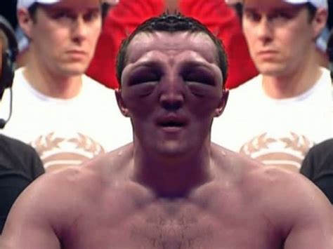 The Most Horrific Post Fight Faces Ever Creepy Gallery Ebaum S World