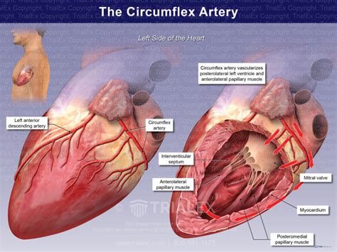 The Circumflex Artery Trial Exhibits Inc