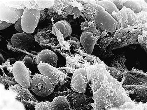 Scientists Crack Genetic Code Of Black Death Germ Yersinia Pestis