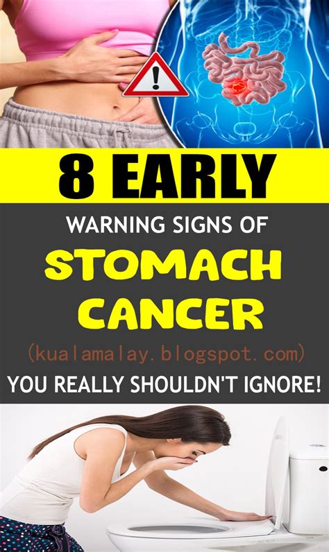 8 Early Warning Signs Of Stomach Cancer You Really Shouldnt Ignore