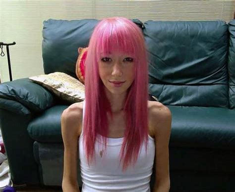 Anorexic Woman Found Willpower To Turn Her Life Around 11 Pics