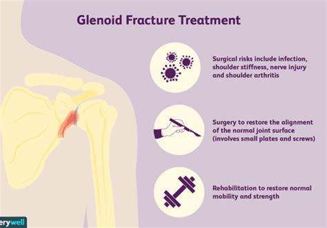 Glenoid Fractures Broken Bone Of The Shoulder Socket
