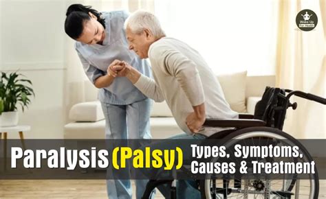 Paralysis And Palsy Types Symptoms Causes And Treatment