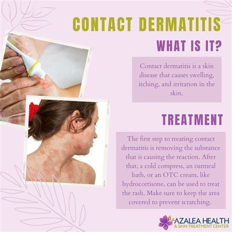 What Is Contact Dermatitis ️ The Condition Known As Contact Dermatitis
