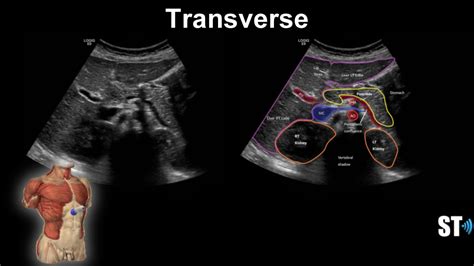 Liver Anatomy And Protocol Sonographic Tendencies