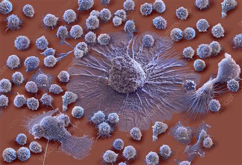This review provides a comprehensive overview of the mechanisms underlying crs pathophysiology, risk factors, clinical presentation, differential diagnoses, and prognostic factors. Cytokine storm, composite SEM - Stock Image - C049/8992 ...