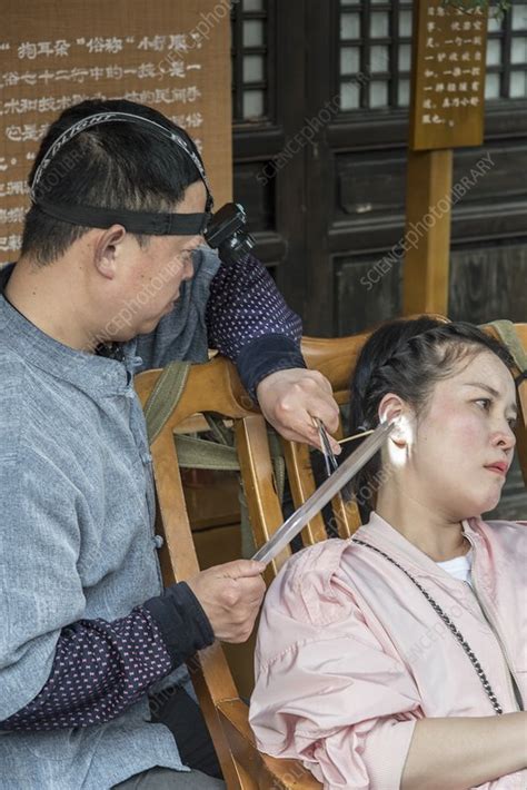 Traditional Chinese Ear Cleaning Stock Image C0476789 Science