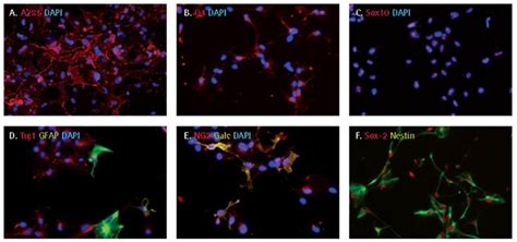 Robust Differentiation Of Human Ipscs Into Lineage Specific Neurons And