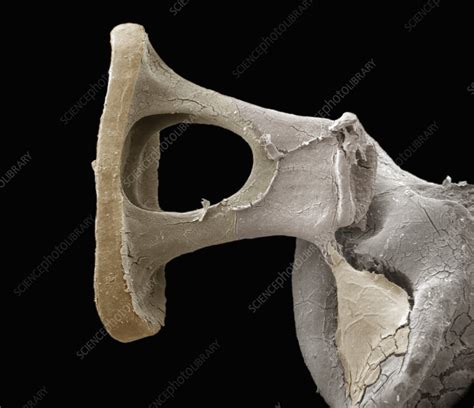 Detail Of Stapes Human Middle Ear Bone Stock Image C0058798