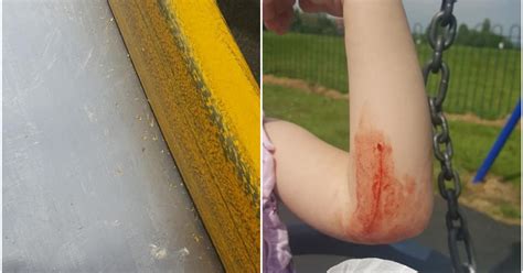 Warning To Parents After Little Girl Cut Her Arm On Broken Glass As She
