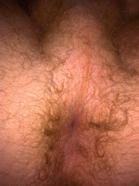 Unwiped Ass Hole Gay Close Up