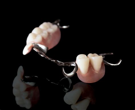 Cast Partial Dentures — Microdental Laboratories
