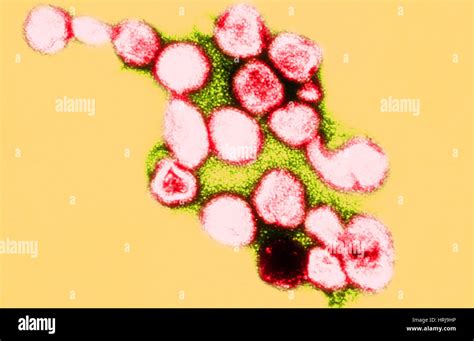 El Virus De La Rubéola Sarampión Alemán Tem Fotografía De Stock Alamy