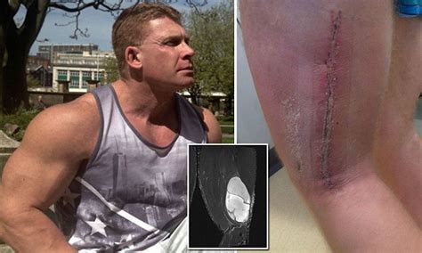 Ex Mr England Body Builder Gary Case Has Melon Sized Tumour Removed