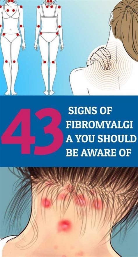 43 Signs Of Fibromyalgia You Should Be Aware Of Signs Of Fibromyalgia