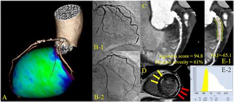 Frontiers Coronary Computed Tomography Angiographic Predictors Of Non