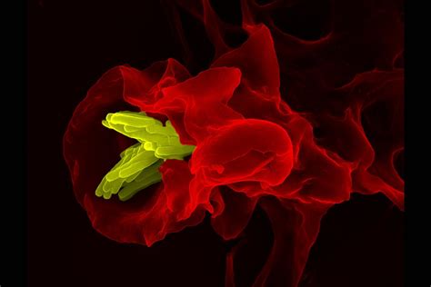 Macrophage Engulfing Tuberculosis Bacteria Macrophage Red Flickr