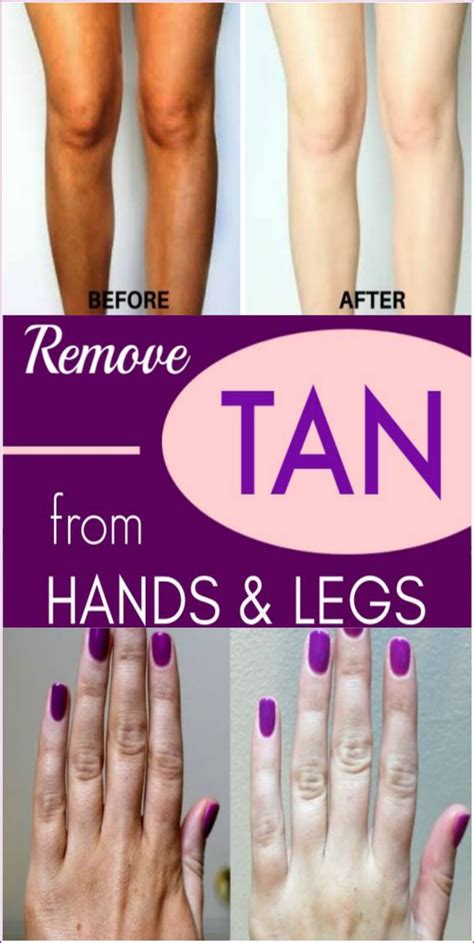 How To Remove Tanning From Hands And Feet Instantly 100 Natural Tan