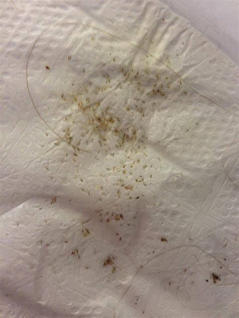 Because the conditioner is so thick it can choke on the lice that tea tree oil cannot destroy. 41 best About Nits-Lice eggs images on Pinterest | Lice ...