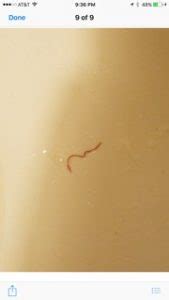 Check spelling or type a new query. Worm in Toilet Likely Bloodworm - All About Worms