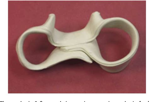 Figure 9 From Relative Motion Orthoses In The Management Of Various
