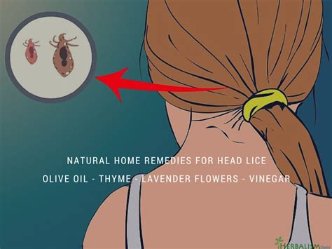 Home Remedies For Head Lice Head Lice Remedy Head Louse Home Remedies