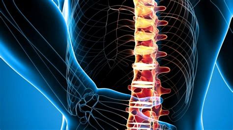 Spinal Fusion Surgery Recovery A Guide To Healing
