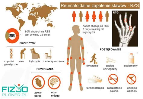 Reumatoidalne zapalenie stawów RZS charakterystyka choroby objawy