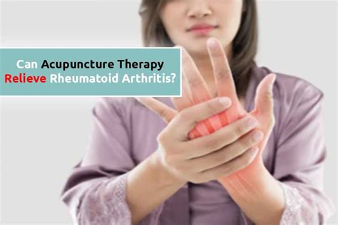 Can Acupuncture Therapy Help To Relieve Rheumatoid Arthritis