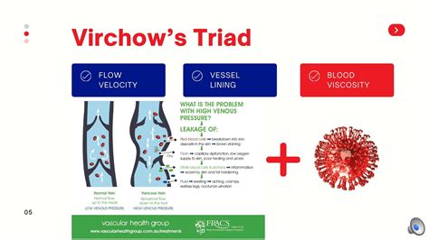 Vascular Health Group Deep Vein Thrombosis