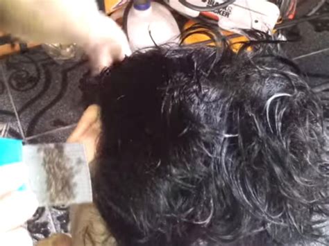 Video Of Horrifying Head Lice Infestation Shows Hundreds Of Nits On A Comb Health News