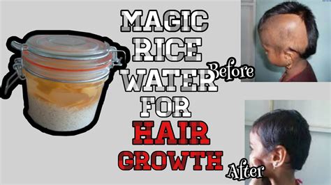 Grow Your Hair While You Sleep With Overnight Rice Water Hair Spray Youtube