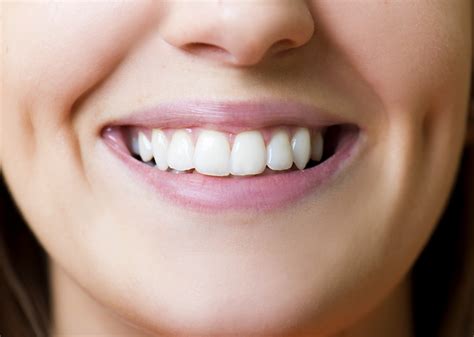 Tooth Whitening Are Your Teeth Discoloured Then You Need Tooth