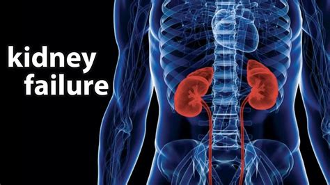 What Is Kidney Failure Cause Symptoms Treatments Healthtian