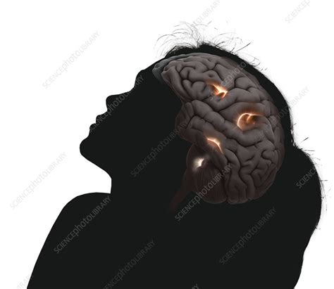 Brain Activity During Sex Conceptual Illustration Stock Image C050 0217 Science Photo Library