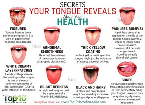10 Secrets Your Tongue Reveals About Your Health Tongue Health