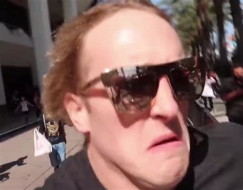Logan Pauls Hairline Image Gallery Know Your Meme