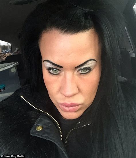 Warrington Woman Obsessed With Fillers Forced Husband To Spend
