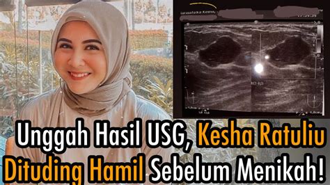 We did not find results for: KESHA RATULIU Dituding Hamil Sebelum Nikah Karena ...