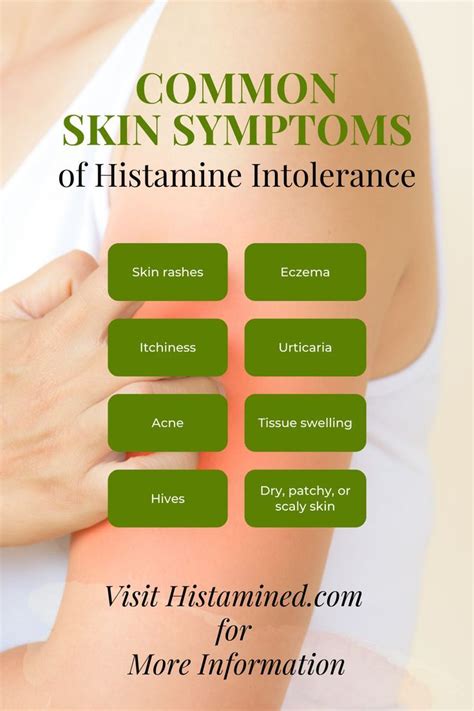Skin Symptoms Of Histamine Intolerance Skin Symptoms Histamine