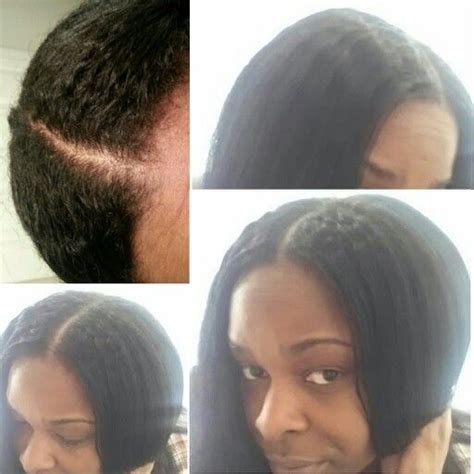 Basically, my hair broke off with the least bit of manipulation. 2Months post relaxer - air dried hair. Texture shot ...