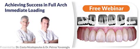 Achieving Success In Full Arch Immediate Loading Southern Implants