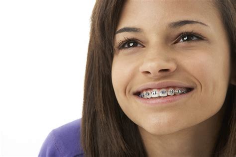 Comparing Clear Aligners Versus Traditional Braces Which Teeth