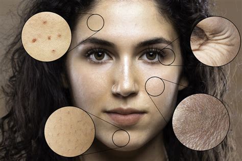 Common Skin Issues In Punes Climate A Dermatologists Guide The
