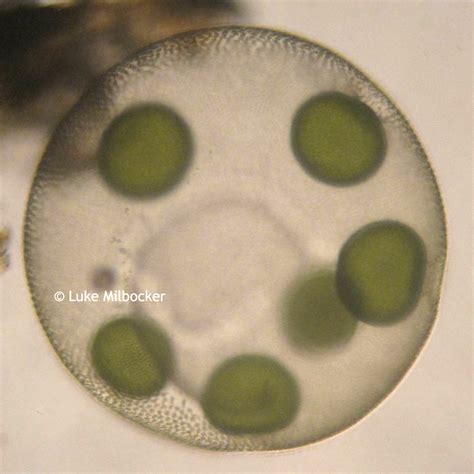 Microscopy Protozoans Microbus Microscope Educational Website