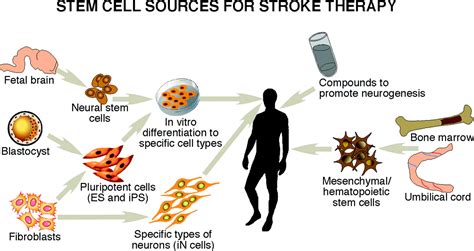 Stem Cell Research In Stroke Stroke