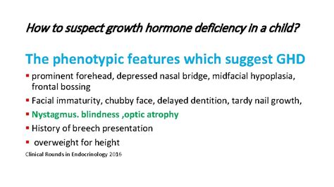 Some Points Recommendations For Diagnosis Growth Hormone Deficiency